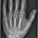 Hand_dv.jpg