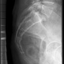 sacrum.jpg