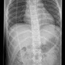 shuntverlauf_abdomen.jpg